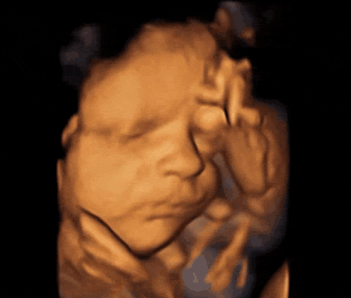 4D ultrasound, baby in motion